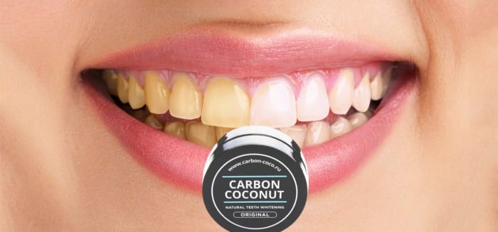 Отзывы врачей о порошке Carbon Coconut (Карбон Коконат) для отбеливания зубов