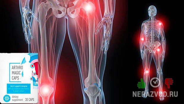 Arthromagic - биодобавка для снятия суставных болей