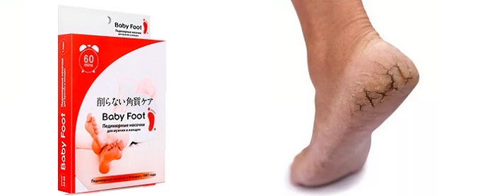 Baby Foot педикюрные носочки для удаления огрубевшей кожи: ножки, как у младенца!