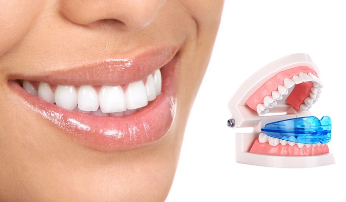 Dental Trainer для выравнивания зубов: восстановите правильный прикус в домашних условиях!