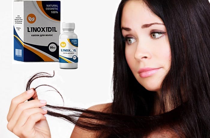 Linoxidil для волос: восстановит упругость и естественный объем ваших локонов!