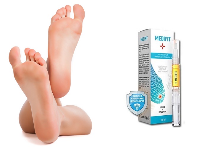 Medifit от грибка: возвращает здоровье и красоту вашим ногам!