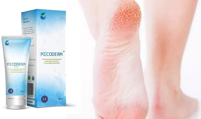 MICODERM от грибка ног и ногтей: эффективно устраняет любые симптомы проявления инфекции!