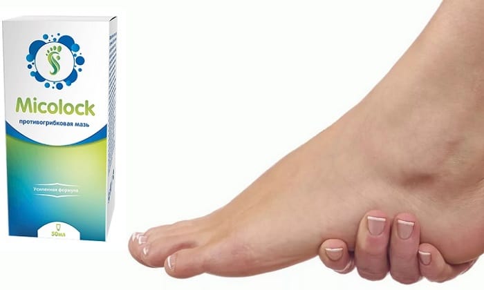 Micolock противогрибковое средство от грибка ногтей и ног: забудьте о неприятном запахе, боли и зуде!