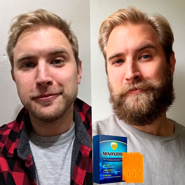 борода до и после