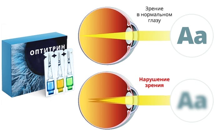 Оптитрин для восстановления зрения: эффективно борется с зависимостью от очков и контактных линз!