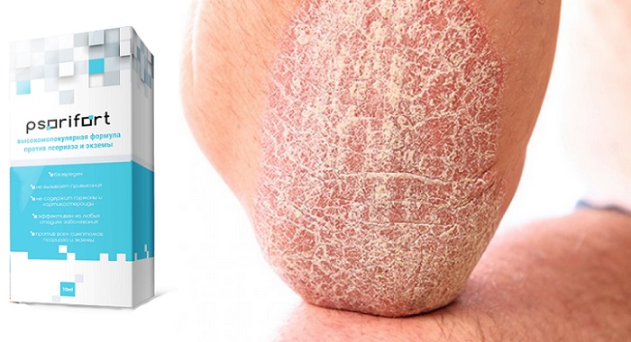 Psorifort комплекс от псориаза: для лечения и профилактики болезней кожи!