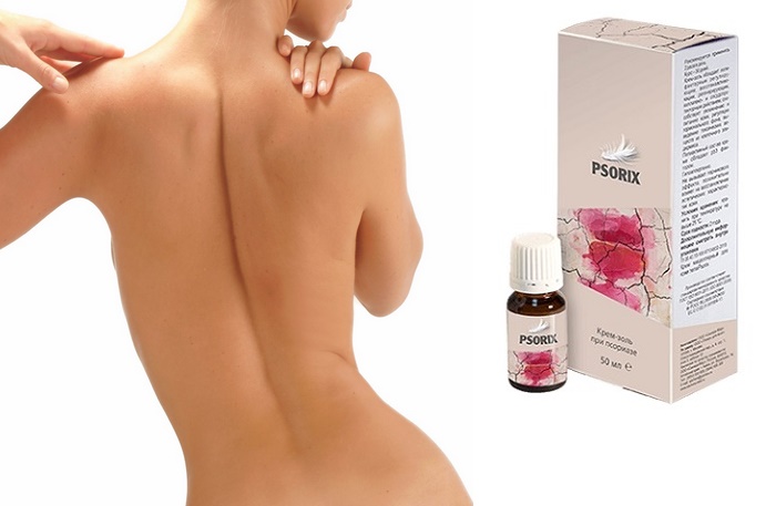 Psorix при псориазе: быстро восстановит кожу и защитит ее от дальнейших повреждений!