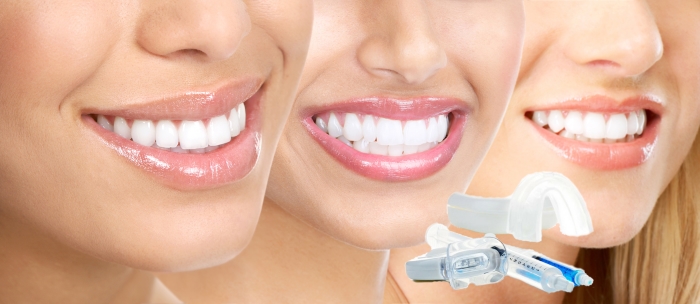 Состав набора SmileFactor (СмайлФактор) для отбеливания зубов