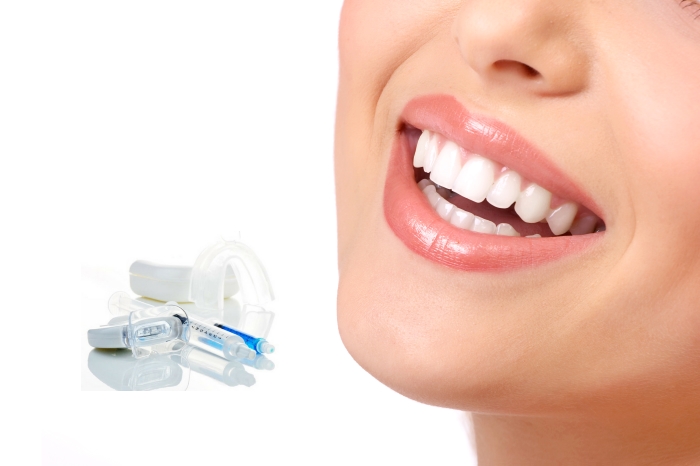 Эффективность набора SmileFactor (СмайлФактор) для отбеливания зубов