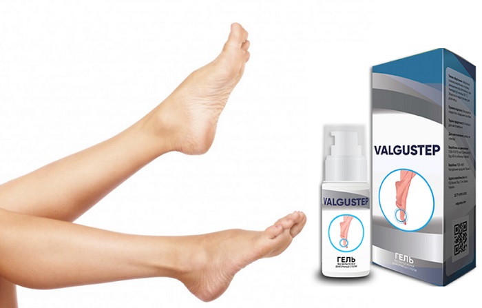 Valgustep от косточки на большом пальце ноги, при вальгусной деформации: устранит нарост и вернет здоровье и красоту вашим ногам!