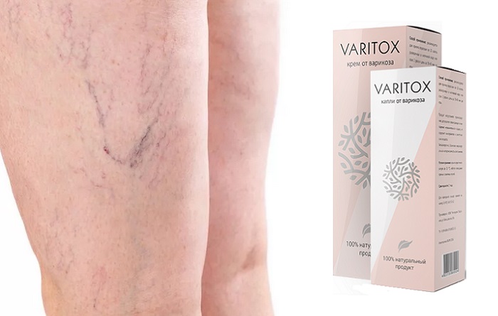 Varitox от варикоза: вы сможете вести полноценную активную жизнь!
