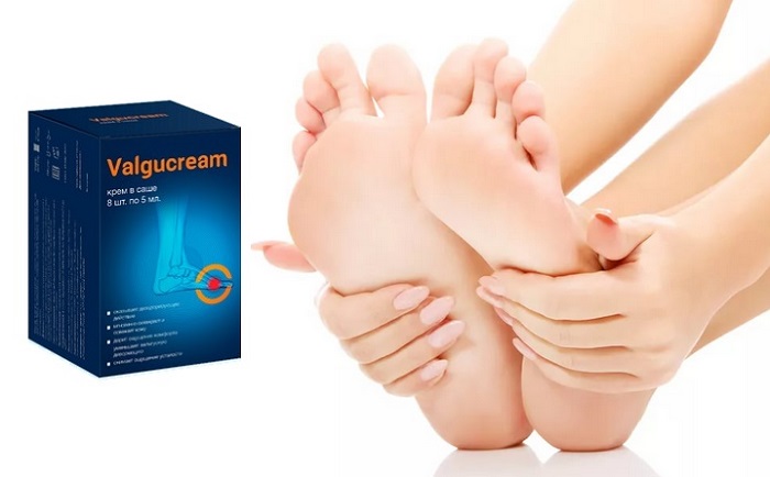 Valgucream для лечения вальгусной деформации стопы: верните привлекательность своим ножкам!