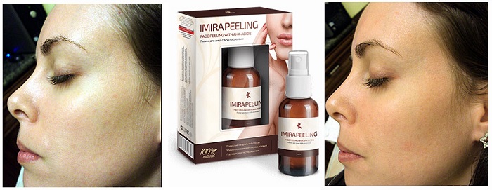Imira peeling для лица, от морщин: мягкий и бережный пилинг без последствий!