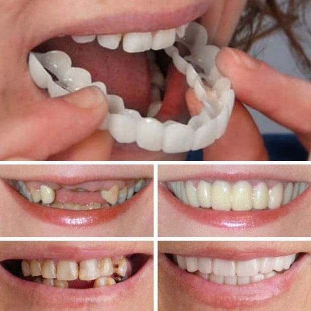 Как раньше устранялись проблемы с зубами