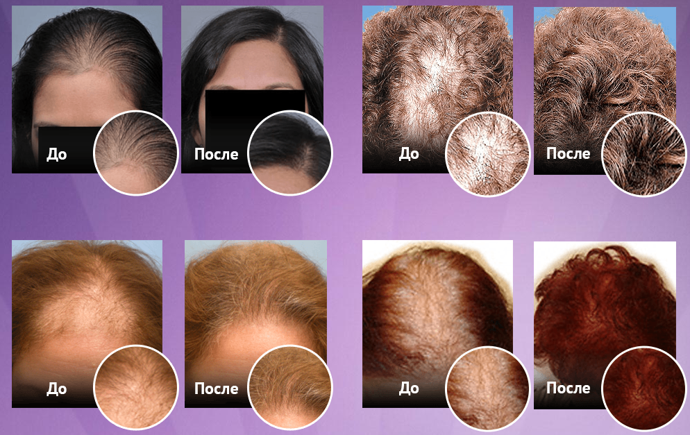 Эффект спрея EXTRAHAIR Экстрахейр для восстановления волос
